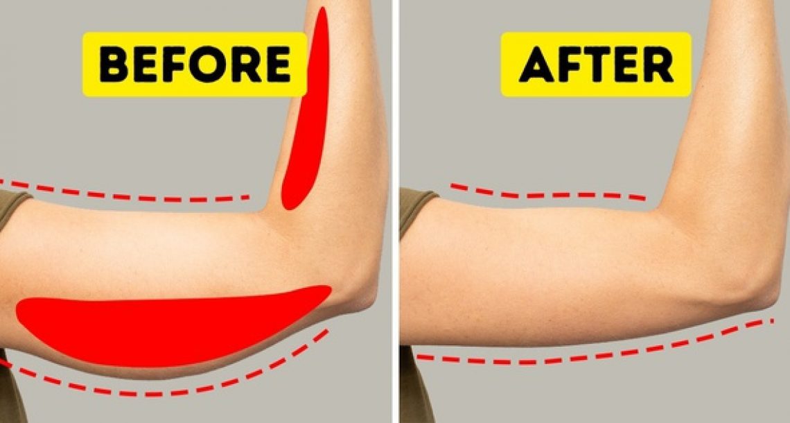 איזה פעילות גופנית מתאימה לתהליך הרזיה ?