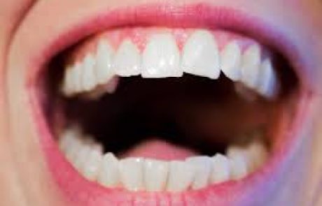 טיפולי שיניים לאסתטיקת הפה